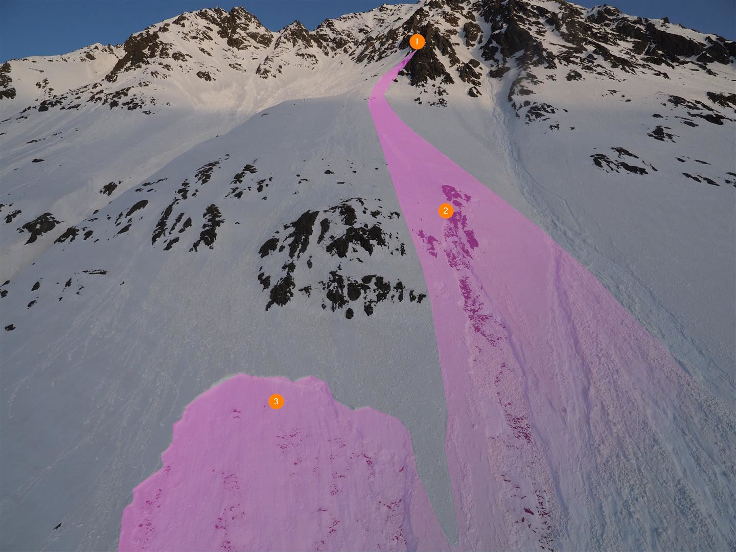 Das Anrissgebiet der Lawine. Mit "1" ist der Ausgangspunkt der Lockerschneelawine markiert. Unterhalb von "2" riss die Schneedecke erstmals in Form einer nassen Lockerschneelawine bis zum Grund durch. "3" markiert dann das seitlich versetzte, schlussendlich ausgelöste Schneebrett. (Foto: 12.04.2024 © LWD Tirol)