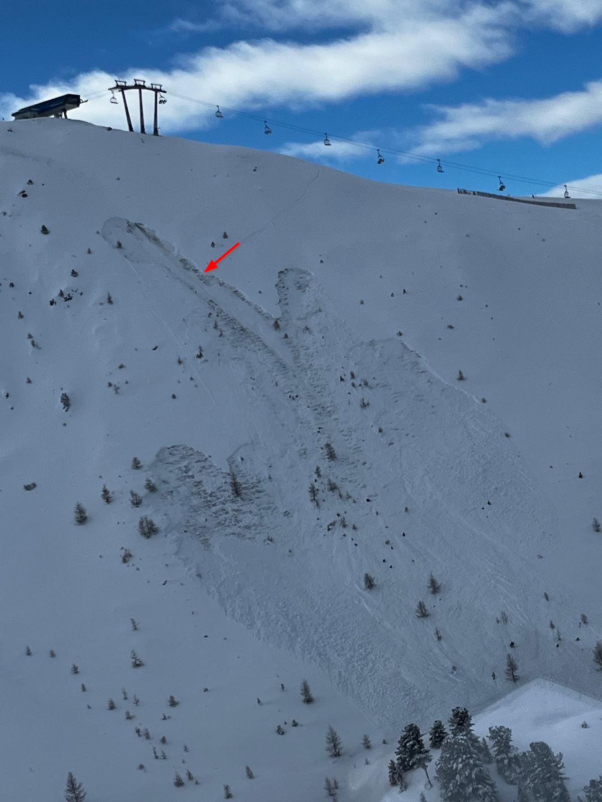 Unterhalb der Bergkastelspitze im Skigebiet Nauders löste ein Variantenfahrer dieses Schneebrett aus. Die Person wurde teilverschüttet und blieb unverletzt. (© Alpinpolizei, 29.01.2025)